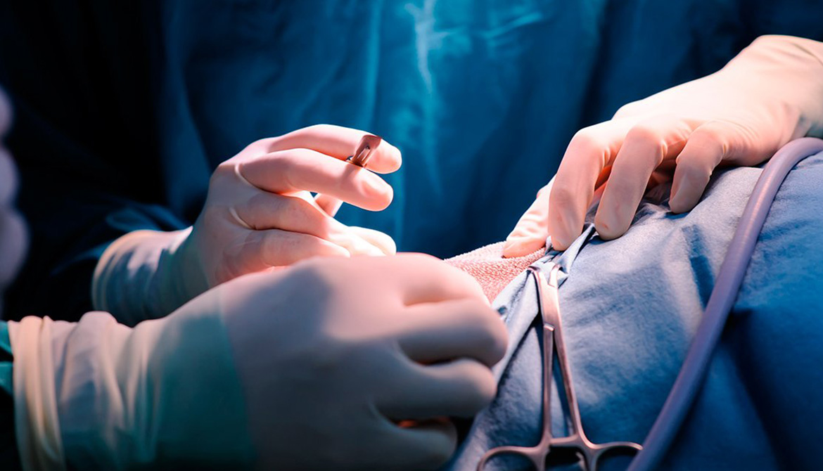 Resolución Quirúrgica de Hernia Umbilical
